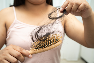 Causes of hair loss